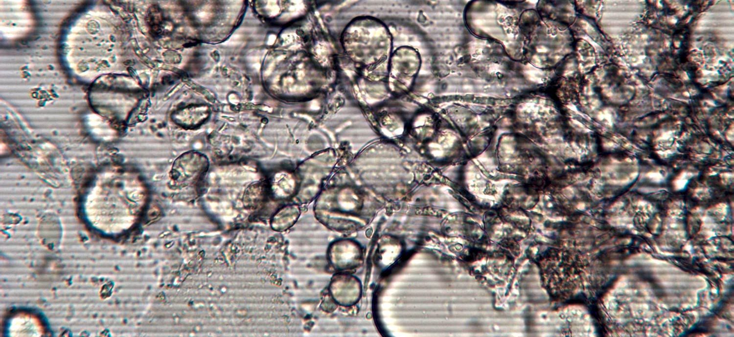 Pilzmyzele in einer Emulsion